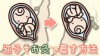 逆子をお灸や鍼で直す治療法 逆子をお灸や鍼で直す治療法