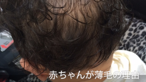 赤ちゃんの髪の毛はいつ伸びる？赤ちゃん期の薄毛ハゲの秘密