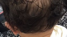 赤ちゃんの髪の毛はいつ伸びる？赤ちゃん期の薄毛ハゲの秘密