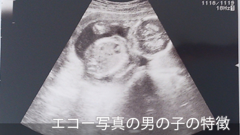 女の子 エコー 特徴