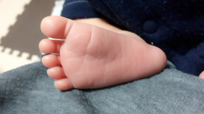 出生体重は低かったが健康に育つ赤ちゃんの足の裏