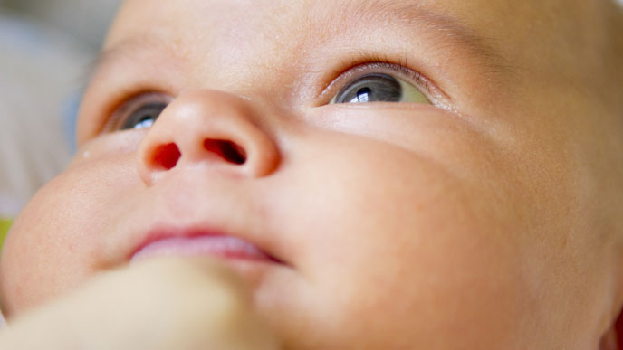 新生児黄疸の疑い