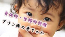 ダウン症の赤ちゃんの判断は？代表的な身体的・性格的特徴