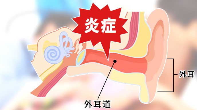 外耳道の場所を示した耳の内部構造のイラスト